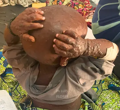 Apoyo a la educación de niñas en Israel